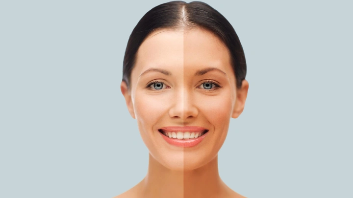 Skin Whitening and Brightening Treatment